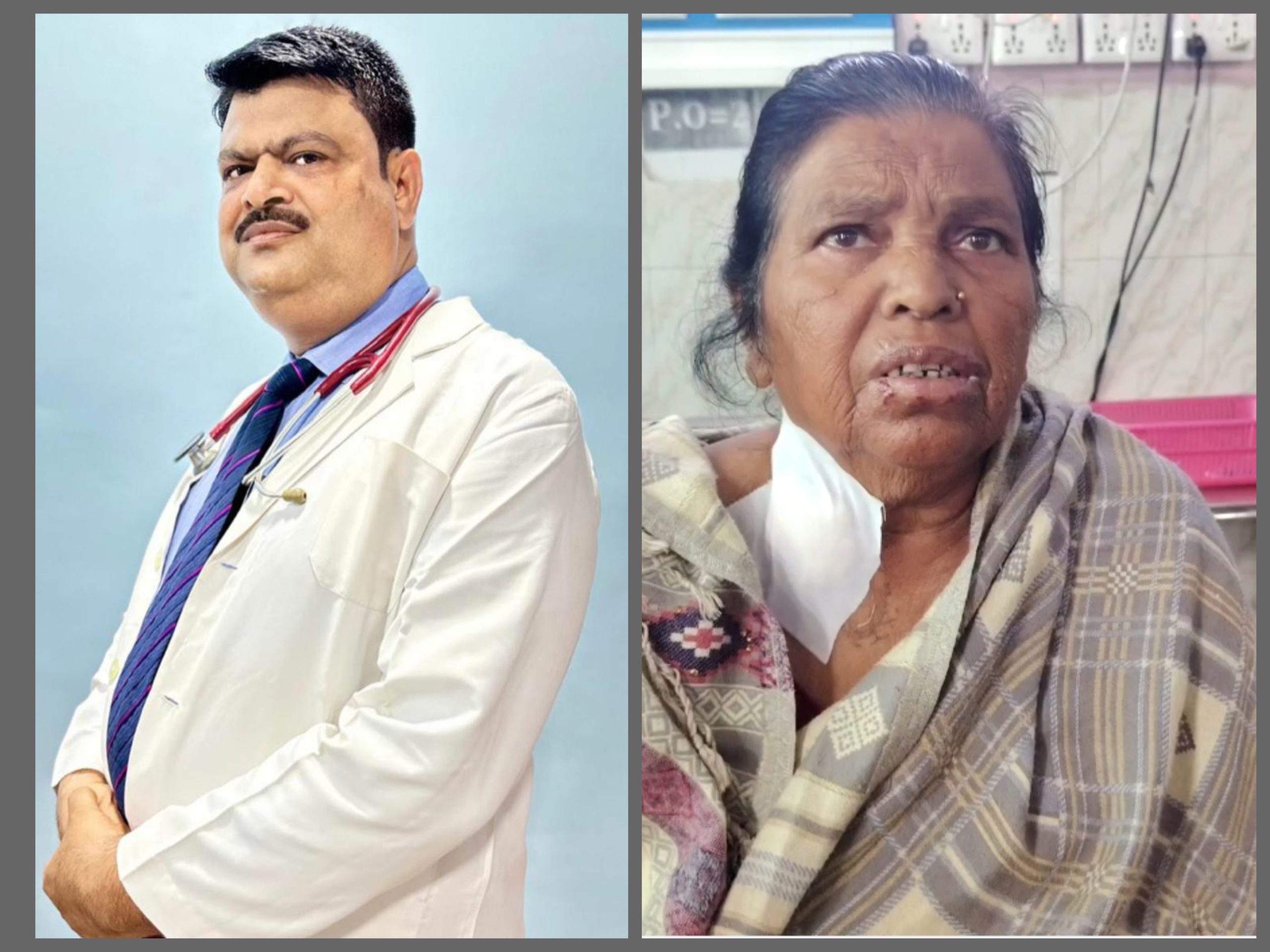 जटिल अवस्थाकी ७६ वर्षीया महिलाको जनकपुरधाममै सफल शल्यक्रिया